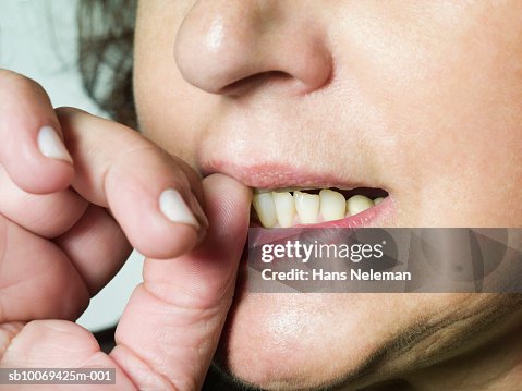 Woman biting nails, close-up Woman biting nails, close-up