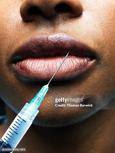 woman receiving injection in lip, close-up - seattle needle stock pictures, royalty-free photos & images