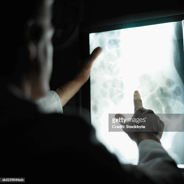 close-up of a mature doctor examining e-ray - pharrell williams of n e r d sighting in new york ctiy stockfoto's en -beelden