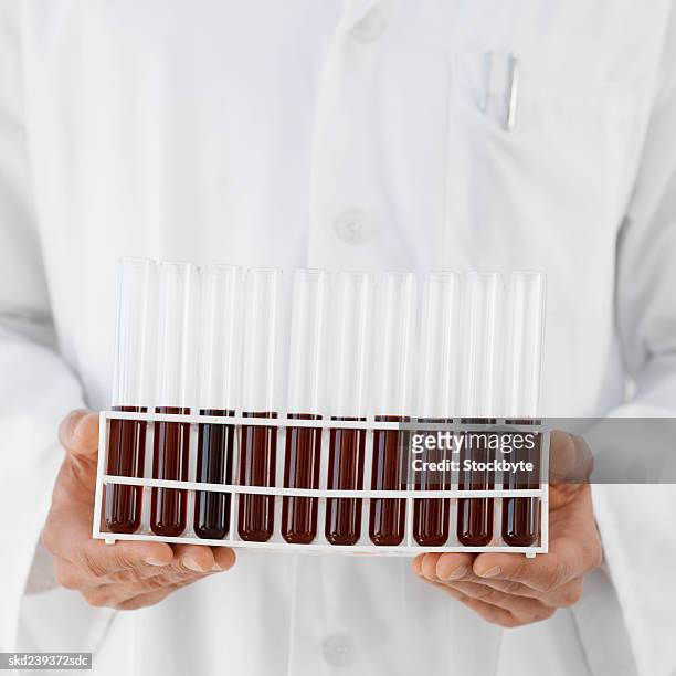 close-up mid section of a doctor holding test tube rack of blood samples - reageerbuisrek stockfoto's en -beelden