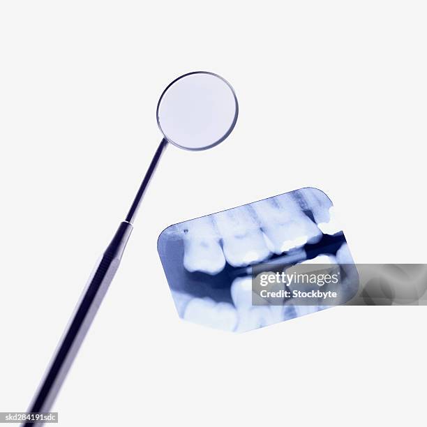 close-up of a teeth x-ray and dental mirror - dental imaging stock pictures, royalty-free photos & images