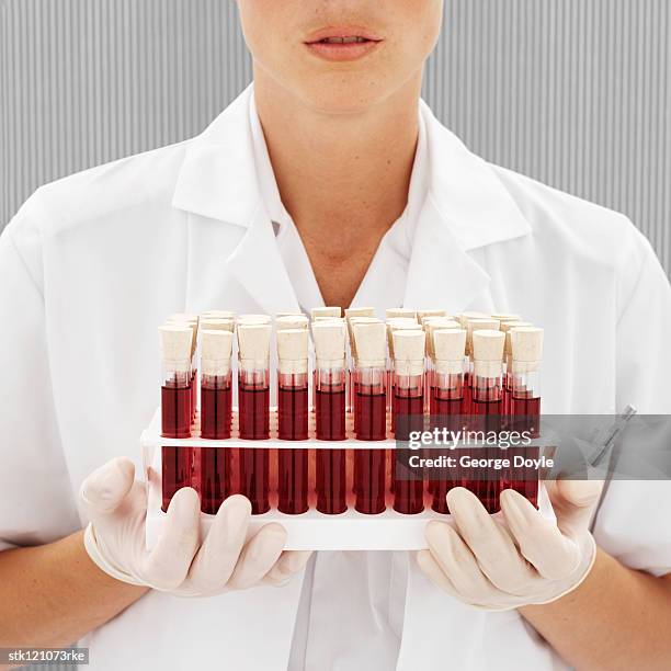 medical personnel holding a rack of sample vials - medical sample stock-fotos und bilder