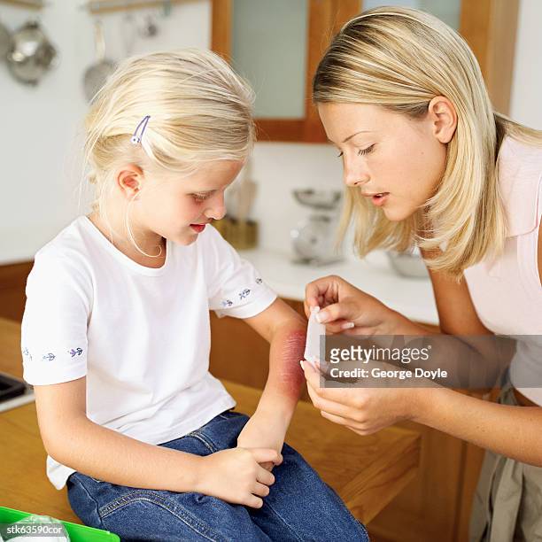 woman dressing wounded elbow of girl (8-10) - wounded stock pictures, royalty-free photos & images