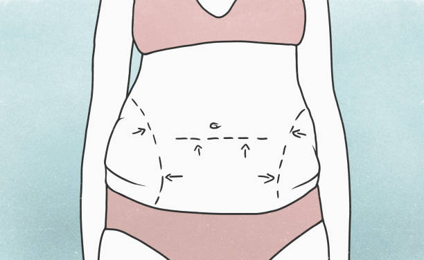 ilustrações, clipart, desenhos animados e ícones de midsection of woman with marked outlines on abdomen - lipoaspiração