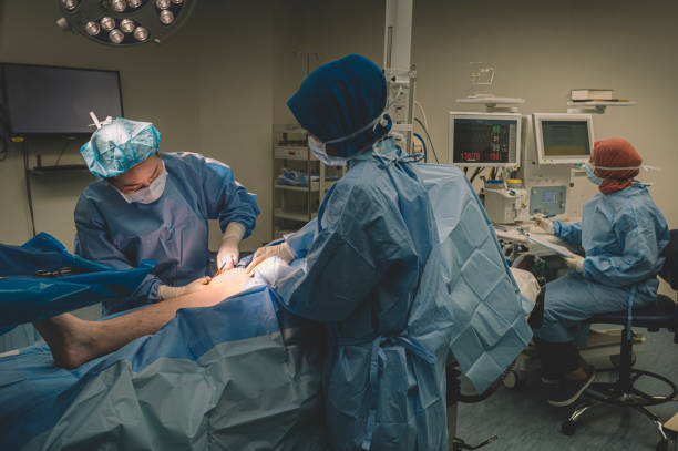 um grupo de cirurgião e de enfermeiras que operam-se no pé de um paciente masculino chinês no quarto de funcionamento - cirurgia varizes - fotografias e filmes do acervo