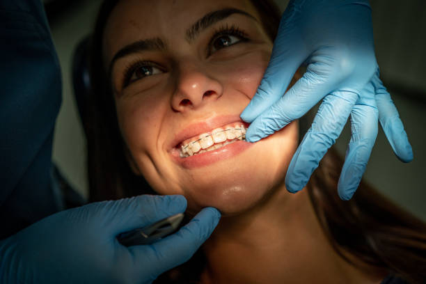 closeup dental braces checkup - ortodontia aparelho  - fotografias e filmes do acervo