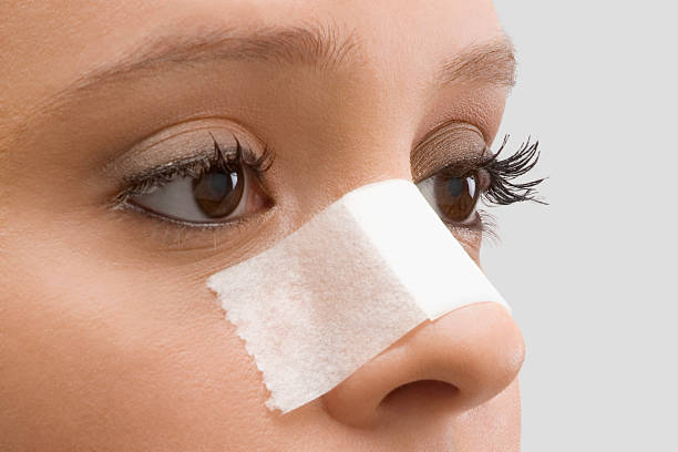 close-up of a female patient with an adhesive bandage on her nose - rinoplastia - fotografias e filmes do acervo