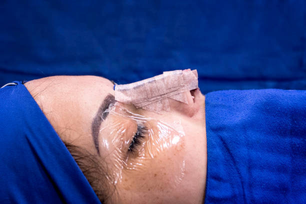 close-up da imagem de perfil de nariz de paciente do sexo feminino após a cirurgia de desvio e rinoplastia septun nasal. - rinoplastia - fotografias e filmes do acervo