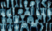 collection x-ray multiple area