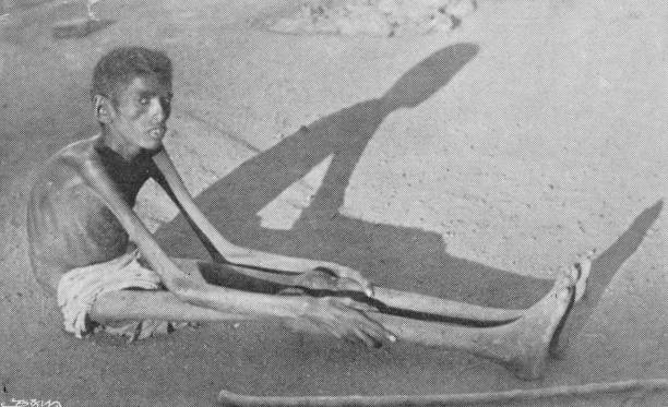 Famine victim in India, 1897.