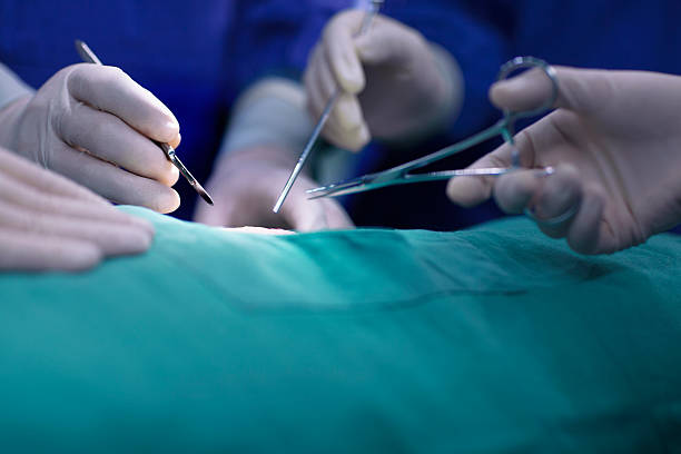 hands of operating room staff performing surgery - ciruigia  - fotografias e filmes do acervo