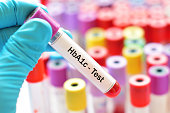 HbA1c test