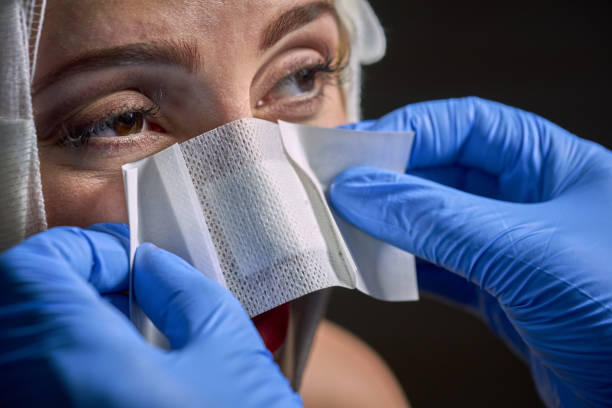 a nurse applies a plaster to a young woman's nose - plastica rinoplastia - fotografias e filmes do acervo