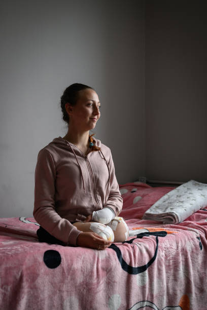 UKR: Ukrainian Nurse Who Lost Legs To Landmine Recovers In Lviv Hospital