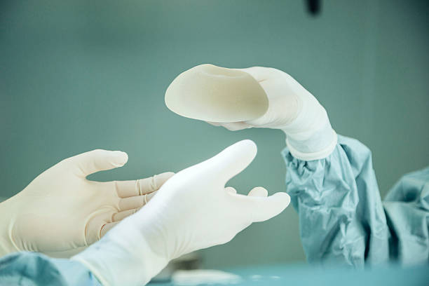 operating room nurse handing silicone implant to surgeon during surgery - silicone - fotografias e filmes do acervo