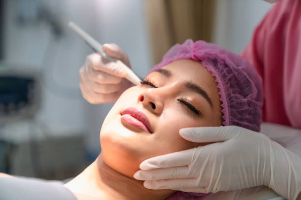 micro dermabrasion