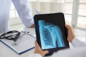 shoulder joint x-ray doctor