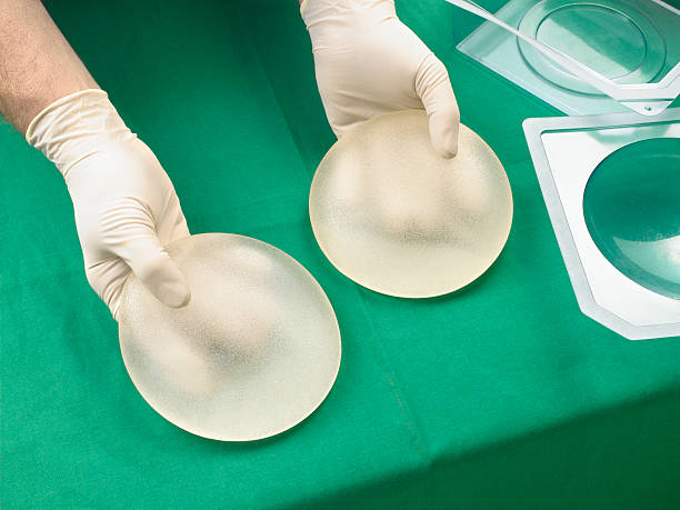 surgeon holding silicone breast implants, close-up, elevated view - silicone - fotografias e filmes do acervo