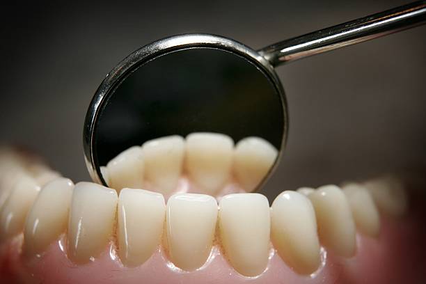 Teeth on a model denture set are reflected in a dental mirror on April 19, 2006 in Great Bookham, England.